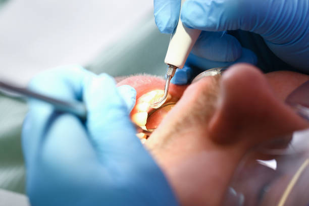 Best Emergency Dental Surgery in Ridgecrest, CA