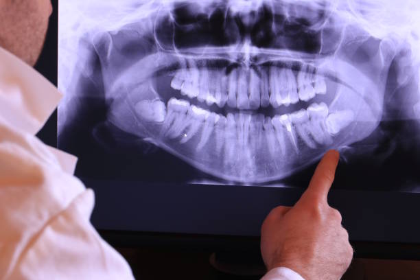 Best Emergency Treatment for Toothache in Ridgecrest, CA